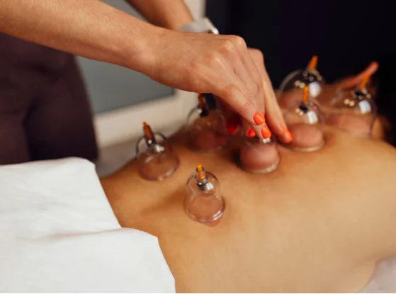 Cupping Therapy