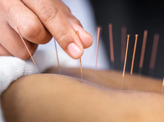 Needling